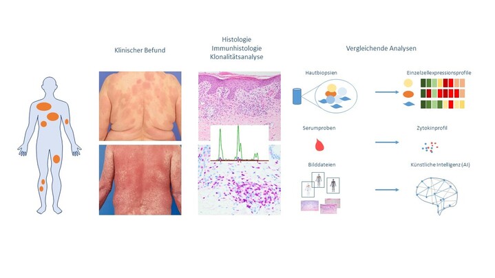 Abbildung-2-Ag-Wobser-Schrama-Hautklinik-Foschunghiilft